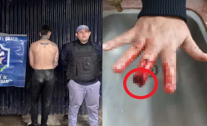 DEDO 2